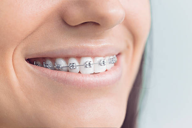 Best Full Mouth Reconstruction  in Mount Pleasant, TX